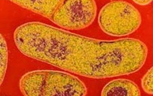 Phòng chống ngộ độc thực phẩm do vi khuẩn Clostridium botulinum